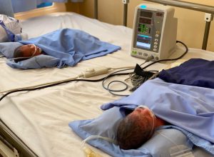 Premature twins in ICU