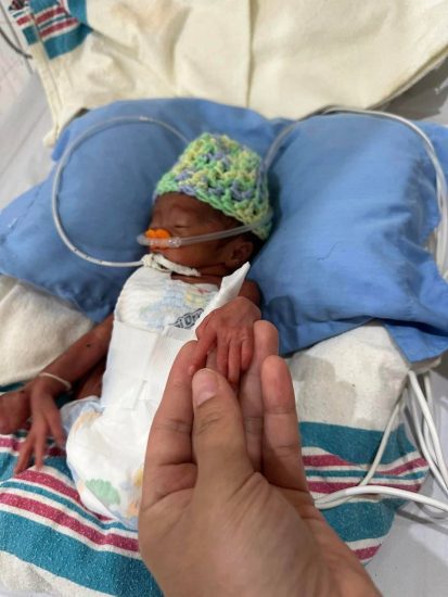 Neonate Neonate